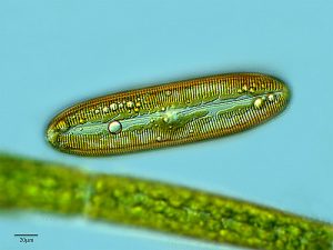 diatom