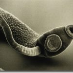 parasitic worm