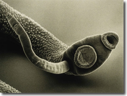 parasitic worm