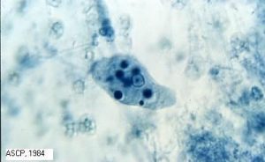 Entamoeba