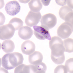 Plasmodium sp.