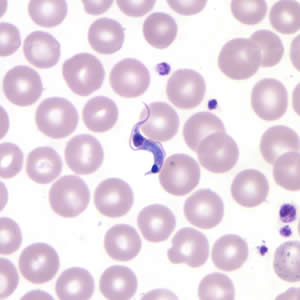 Trypanosoma in blood